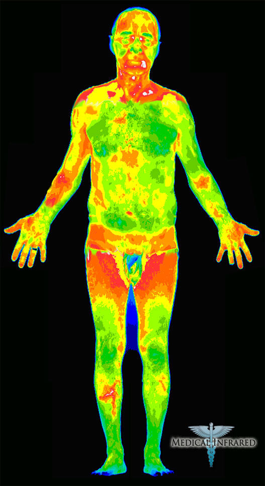 Thermal-Infrared